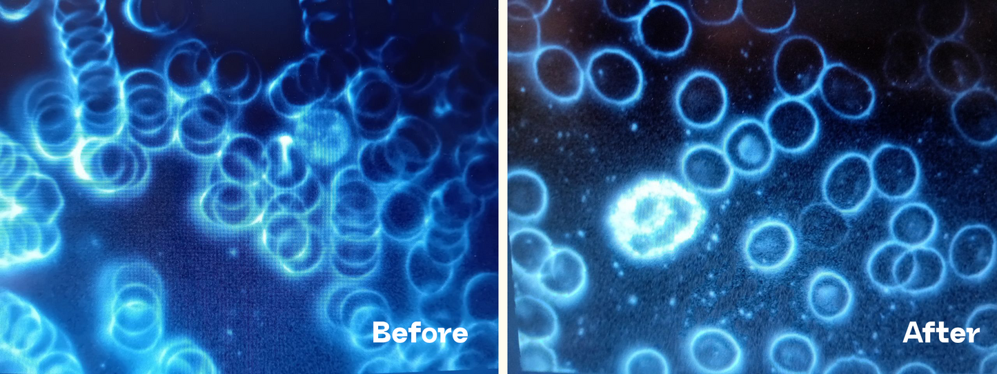 Soma Blanket - Double Layer